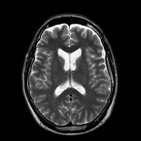 Radiological anatomy: A must-have tool for every medical student