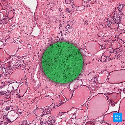 Reticular connective tissue; Image: 