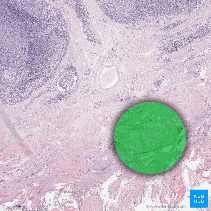 Retrotonsillar soft tissue; Image: 