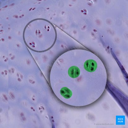 Aggregatio isogenica chondrocyti (Isogene Gruppe von Chondrozyten); Bild: 