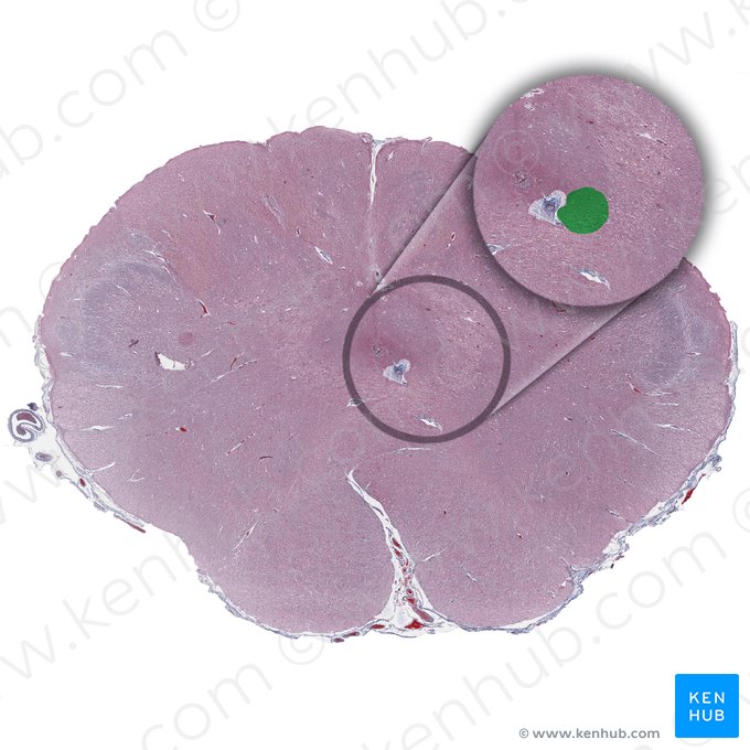 Núcleo do nervo hipoglosso (Nucleus nervi hypoglossi); Imagem: 