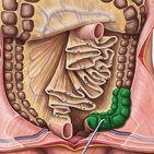 Sigmoid colon