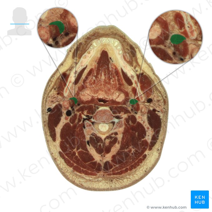 Músculo estilo-hióideo (Musculus stylohyoideus); Imagem: National Library of Medicine