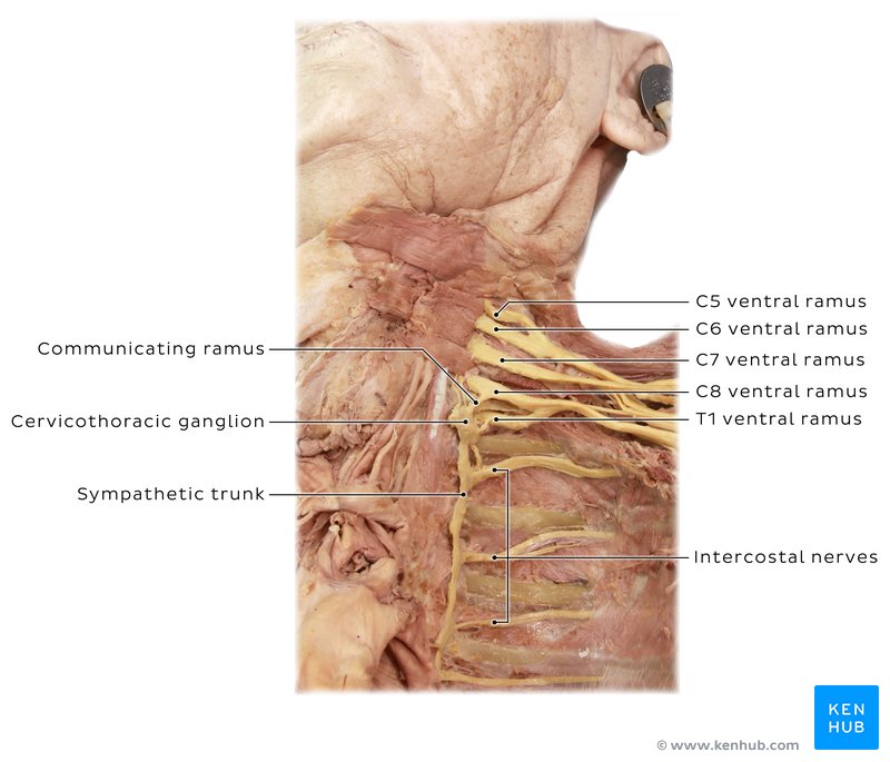 Brachial plexus, stellate ganglion and sympathetic trunk - anterior view