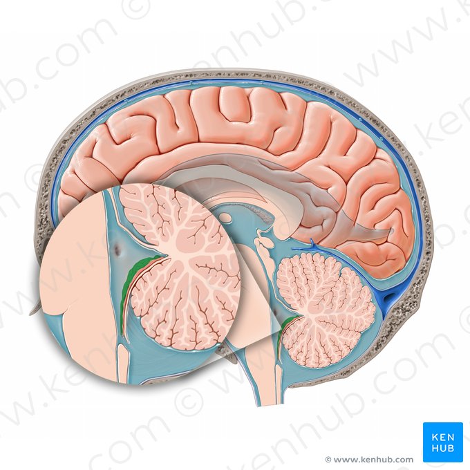 Plexo corióideo do quarto ventrículo (Plexus choroideus ventriculi quarti); Imagem: Paul Kim