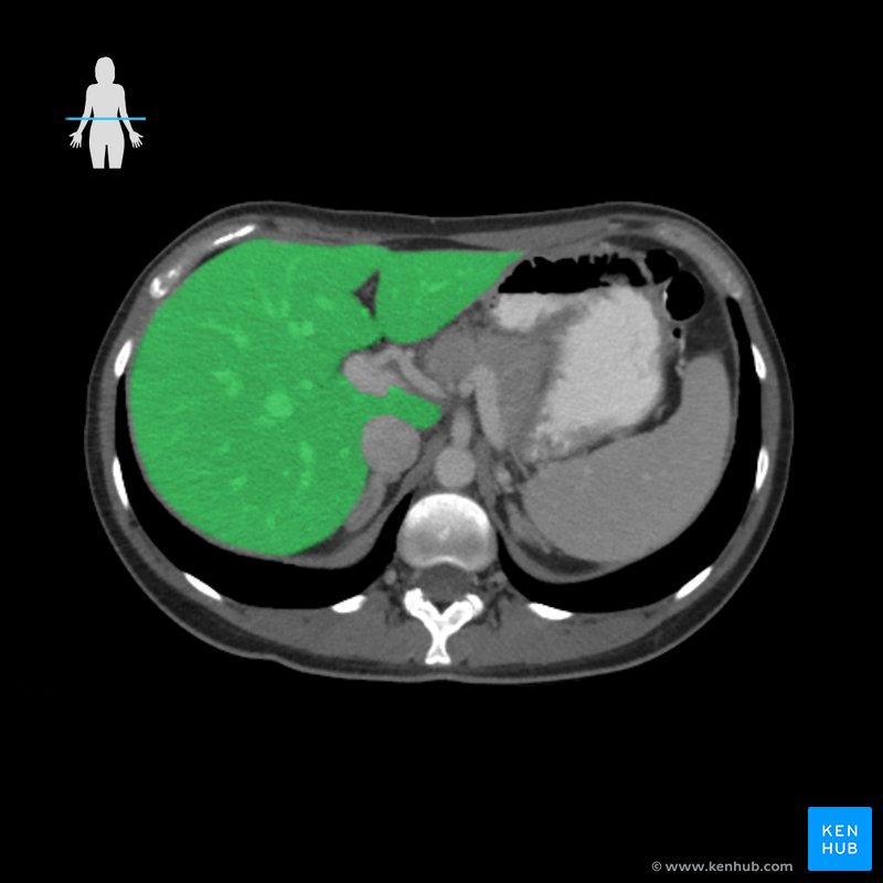 Leber - Radiologie