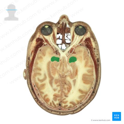 Amygdaloid body (Corpus amygdaloideum); Image: National Library of Medicine