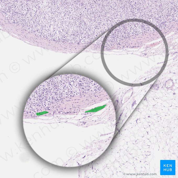 Capsular capillaries; Image: 