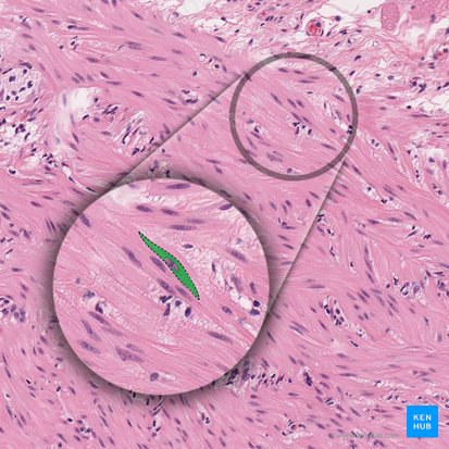 Sarcoplasma (Sarkoplasma); Bild: 