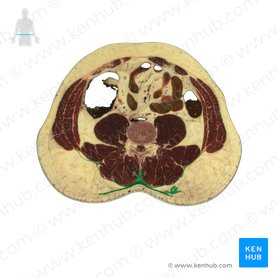 Thoracolumbar fascia (Fascia thoracolumbalis); Image: National Library of Medicine