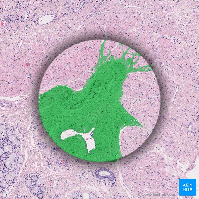 Dense irregular connective tissue; Image: 