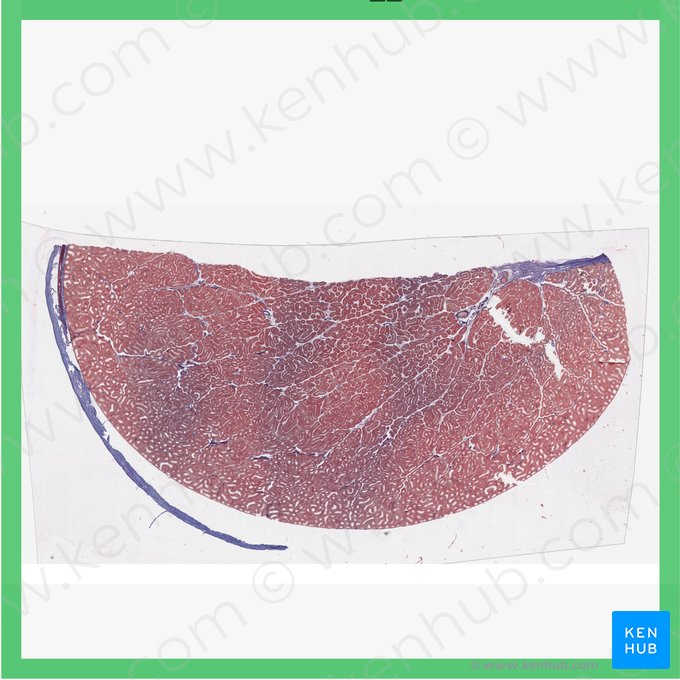 Testículo (Testis); Imagen: 