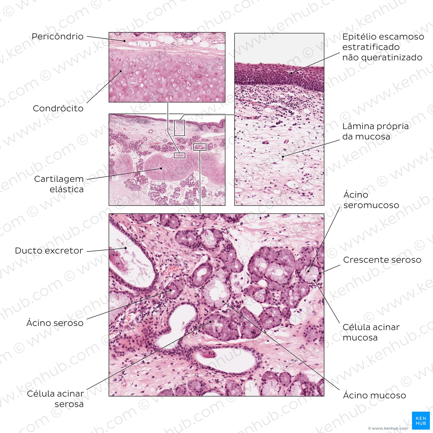 Epiglote. Coloração: H + E. Ampliação média/alta.