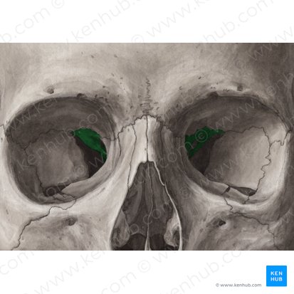 Lesser wing of sphenoid bone (Ala minor ossis sphenoidalis); Image: Yousun Koh