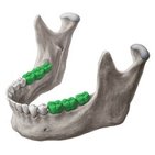 Dente molar