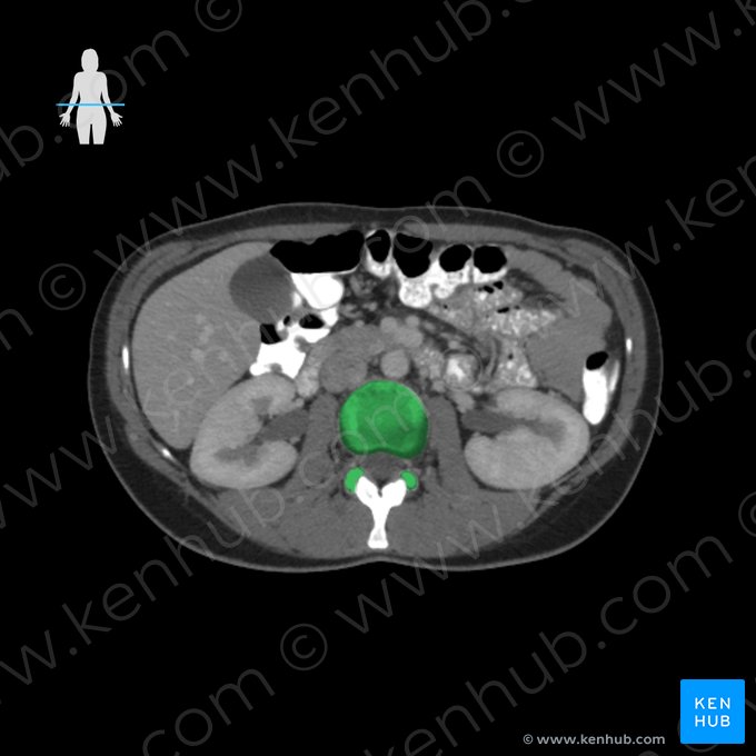 Vértebra L3 (Vertebra L3); Imagem: 