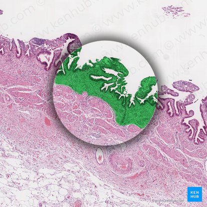 Tunica mucosa (Schleimhaut); Bild: 