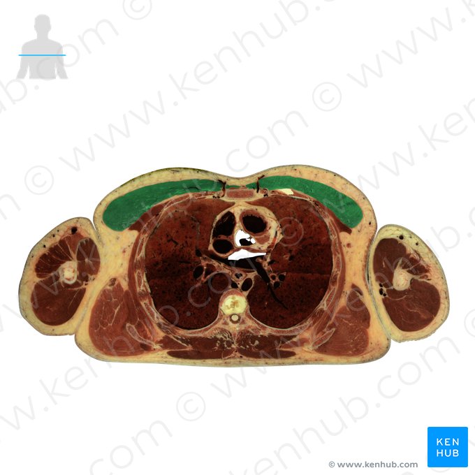 Musculus pectoralis major (Großer Brustmuskel); Bild: National Library of Medicine