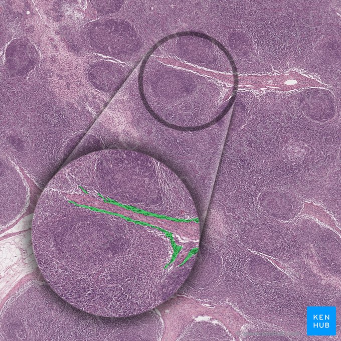 Sinus internodularis (Radiärsinus); Bild: 