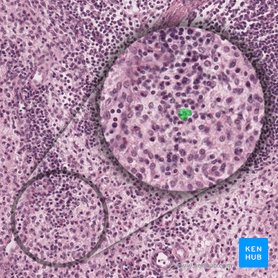 Macrophage (Macrophagocytus); Image: 