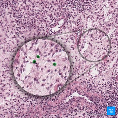 Linfocito (Lymphocytus); Imagen: 