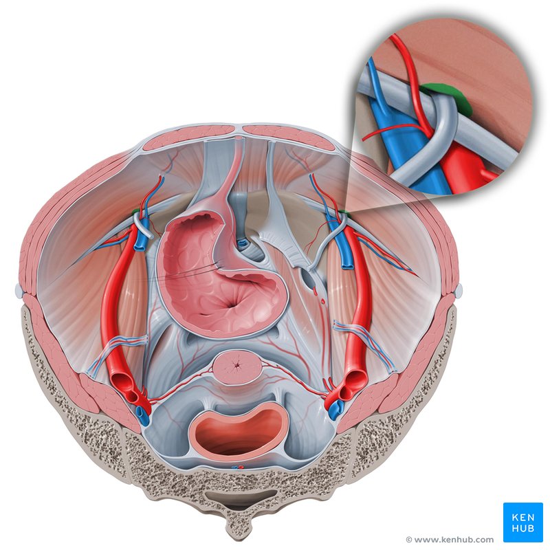 Deep inguinal ring