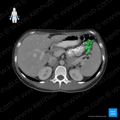 Descending colon (Colon descendens); Image: 