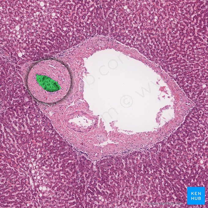 Conductos biliares interlobulillares (Ductus bilifer interlobularis); Imagen: 