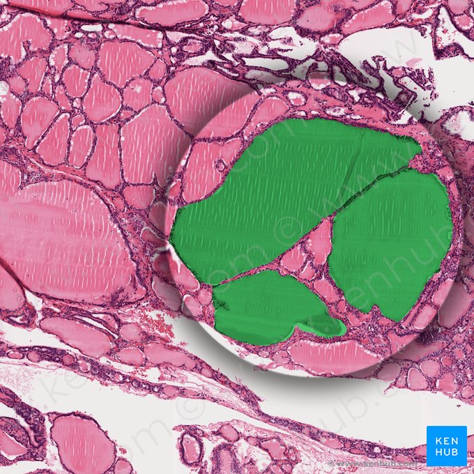 Thyroid follicle (Folliculus thyroideus); Image: 