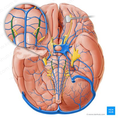 Vena anterolateralis pontis (Vordere seitliche Brückenvene); Bild: Paul Kim