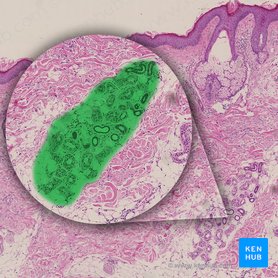 Eccrine sweat gland (Glandula sudorifera eccrina); Image: 