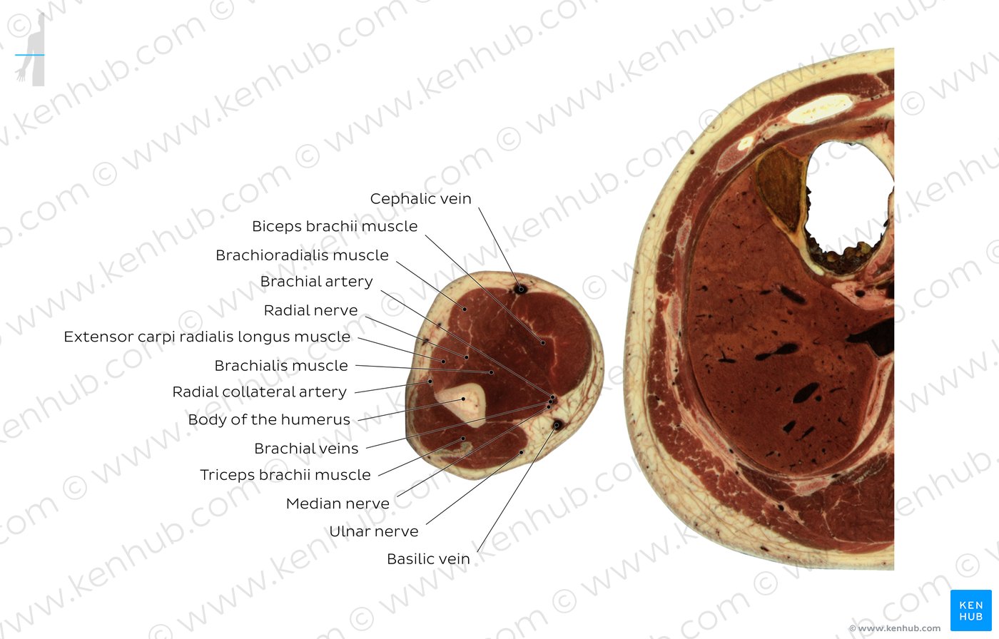 Brachialis muscle level: Overview