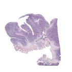 Tonsille