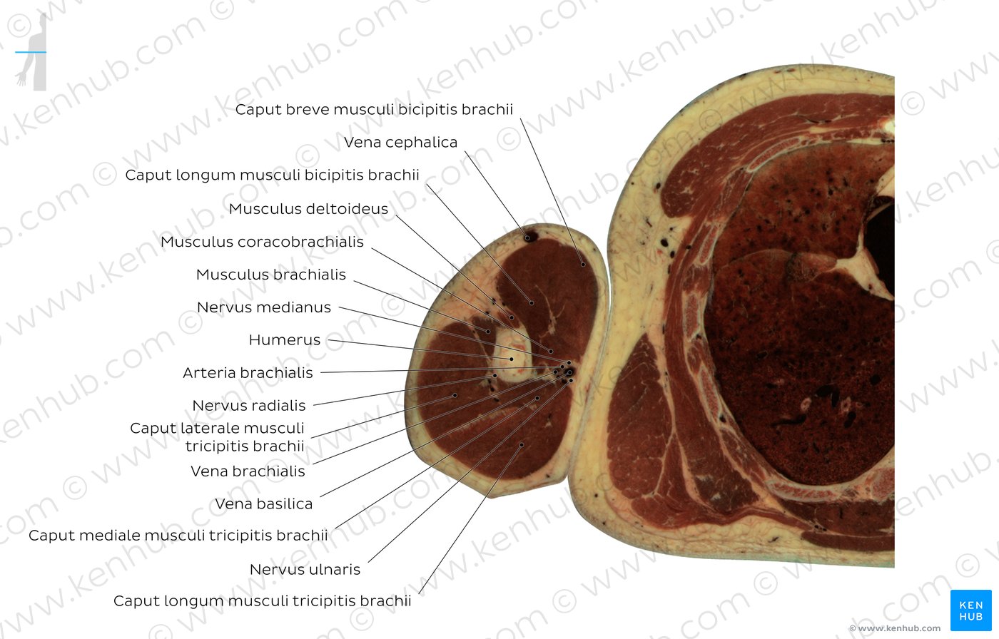 Schnittbild auf Höhe des M. biceps brachii