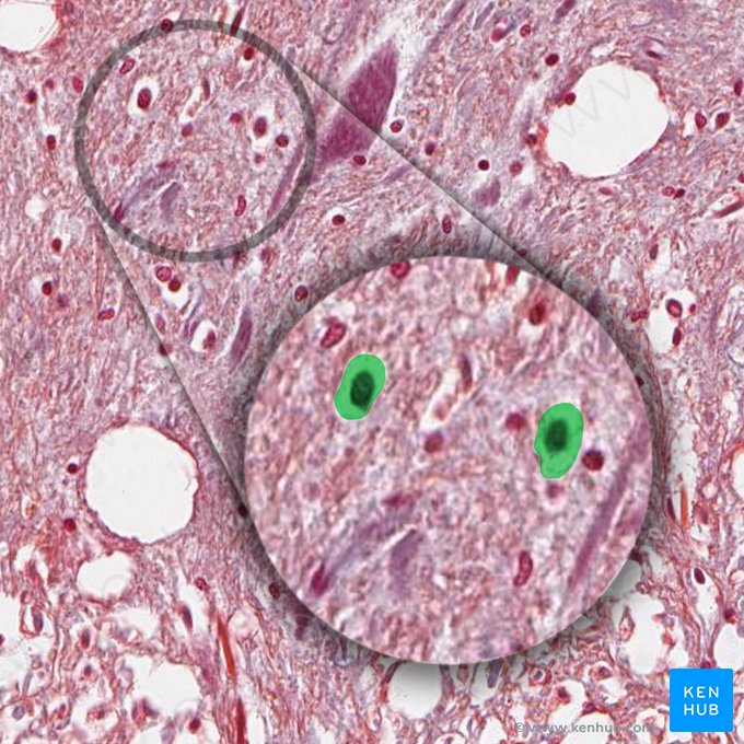 Oligodendrocytus (Oligodendrozyt); Bild: 