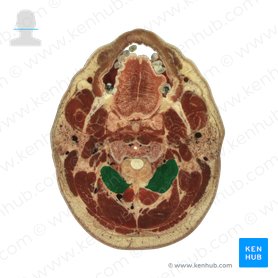 Obliquus capitis inferior muscle (Musculus obliquus capitis inferior); Image: National Library of Medicine