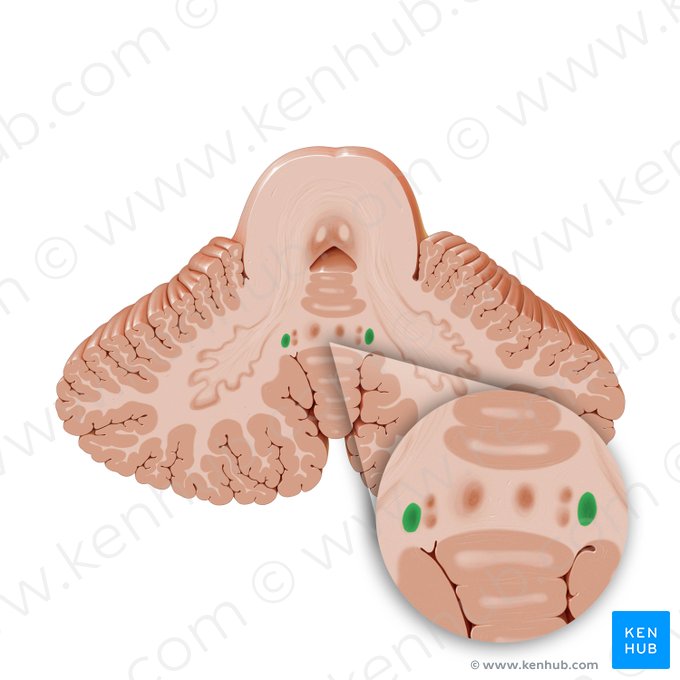 Nucleus emboliformis (Pfropfenförmiger Kern); Bild: Paul Kim