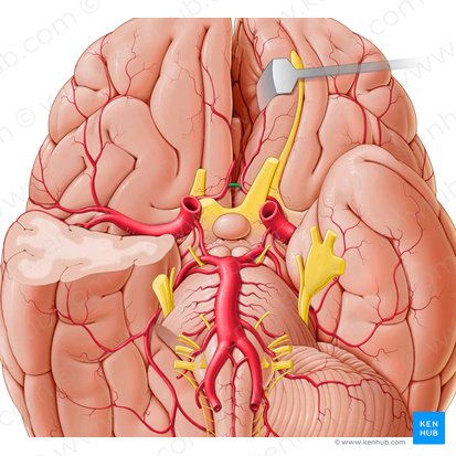 Arteria comunicante anterior (Arteria communicans anterior); Imagen: Paul Kim
