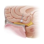 Olfactory nerve