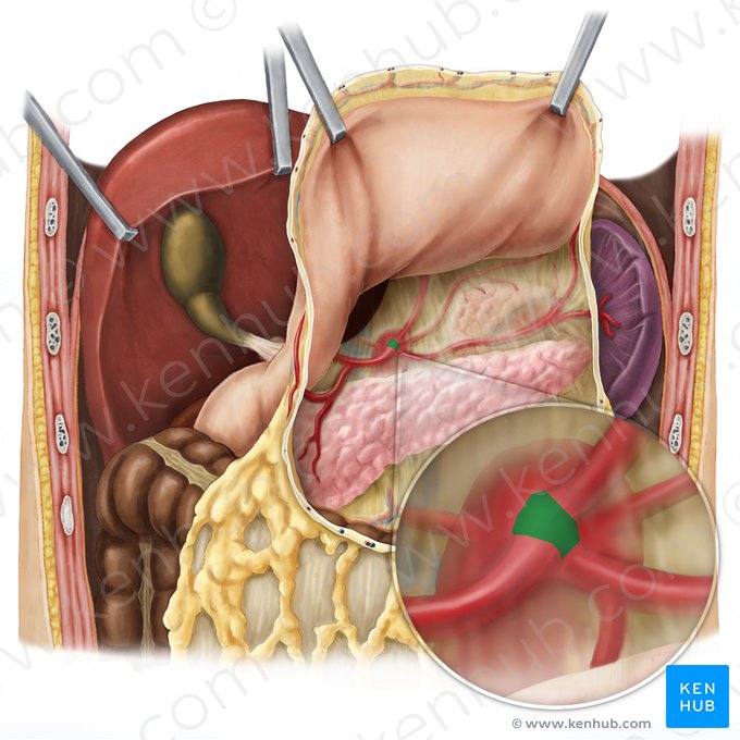 Celiac trunk (Truncus coeliacus); Image: Esther Gollan