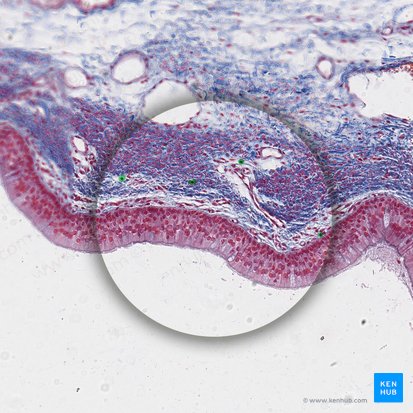 Linfócito (Lymphocytus); Imagem: 