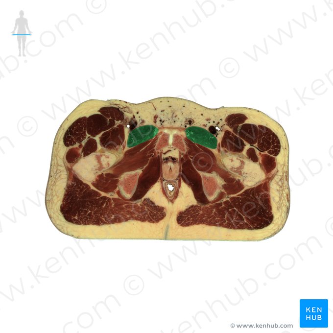 Músculo pectíneo (Musculus pectineus); Imagem: National Library of Medicine