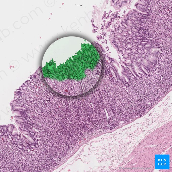 Foveolar epithelium (Epithelia foveolae gastricae); Image: 