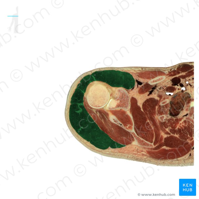 Deltoid muscle (Musculus deltoideus); Image: National Library of Medicine