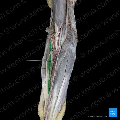 Musculus extensor carpi radialis brevis (Kurzer speichenseitiger Handstrecker); Bild: 