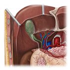Gallbladder