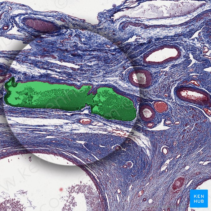 Ovarian vein (Vena ovarica); Image: 