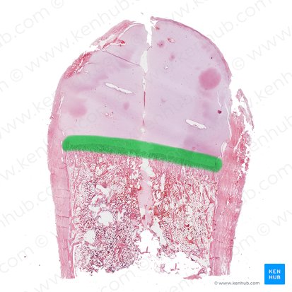Epiphyseal plate (Lamina epiphysialis); Image: 