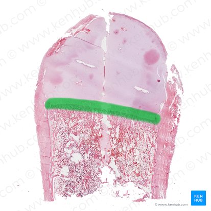 Placa epifisiaria (Lamina epiphysialis); Imagen: 