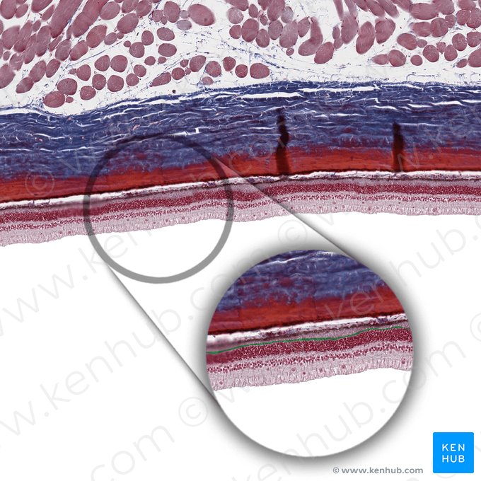 Membrana limitante externa (Stratum limitans externum retinae); Imagen: 